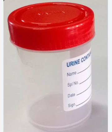 URINE CONTAINER, PP MATERIAL, VOL.60ML, with label