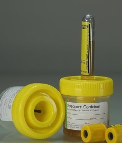 Vacuum urine collecter with tube 60ml