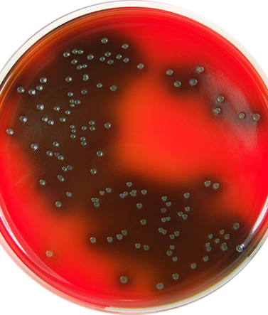 Listeria Identification Agar Base (PALCAM) - 500 G